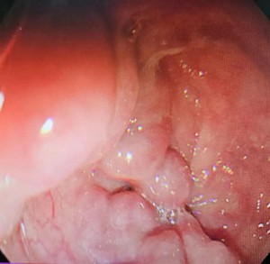 تصويرون gastroscopy تحت پيش ڪيون ويون آهن